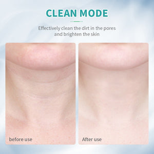 ANLAN Neck Face Beauty Rejuvenating Wand